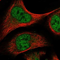 ELK4 Antibody, Novus Biologicals:Antibodies:Primary Antibodies